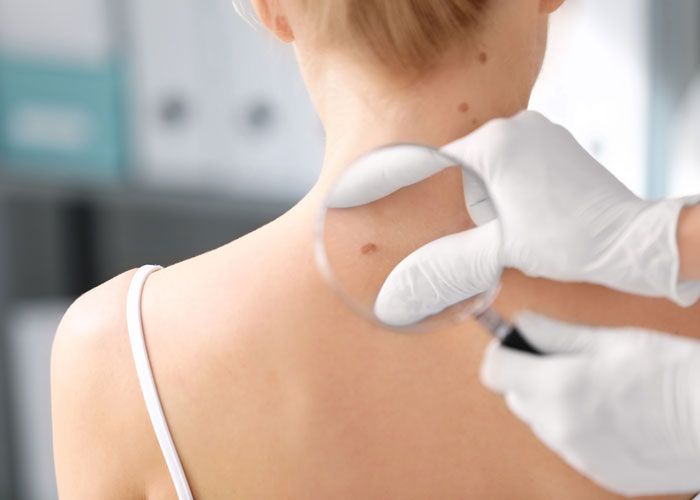Skin biopsy